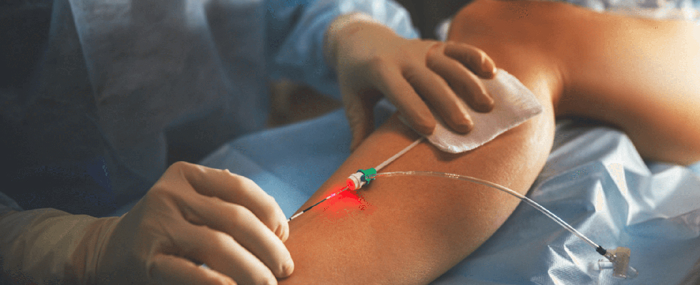 Best Procedures to Prevent Vein Pain