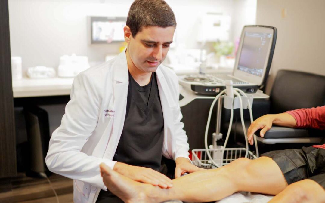 Top Spider Vein Treatments in National City, CA Vein Clinic