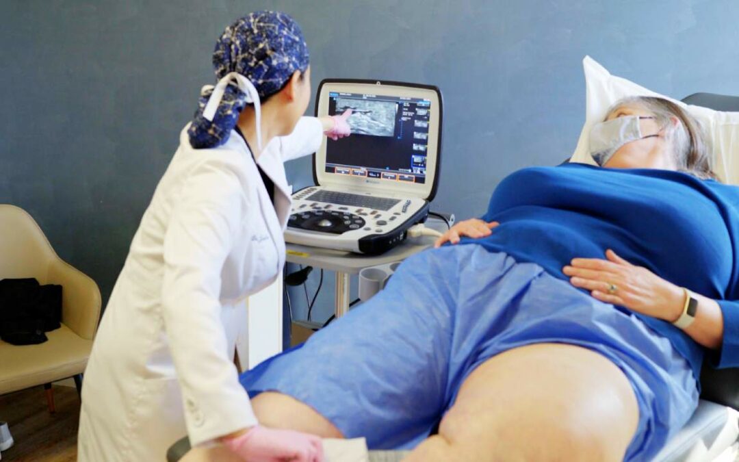 This is How You Can Relieve Your Varicose Vein Pain!