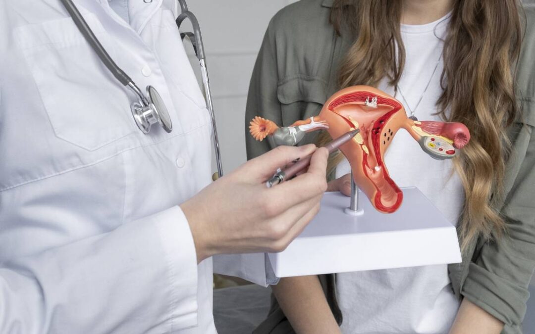 Fibroid Embolization: Top Treatment for Uterine Fibroids