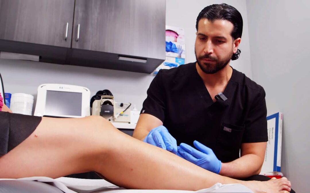How to Get Rid of Spider Veins? 5 Popular Treatments