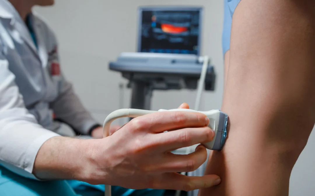 Find the best chronic venous insufficiency treatment for varicose veins in Cedar Park, TX