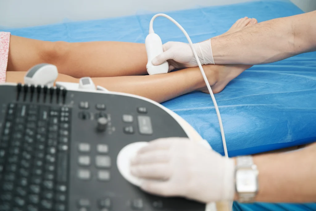 Find the Best Spider Vein Treatment in Hamden, CT, With Dr. Martin Tyson
