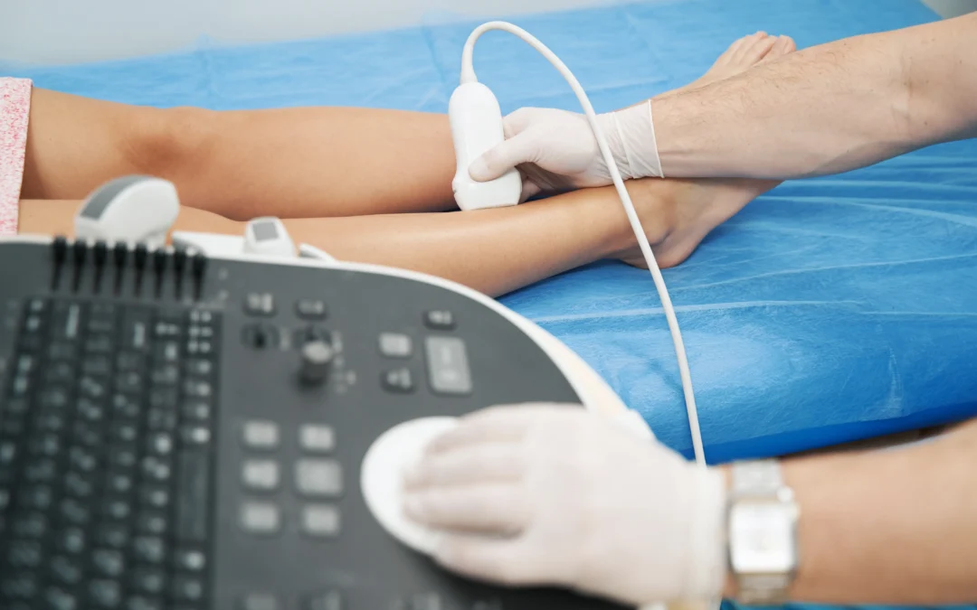 Find the Best Spider Vein Treatment in Hamden, CT, With Dr. Martin Tyson