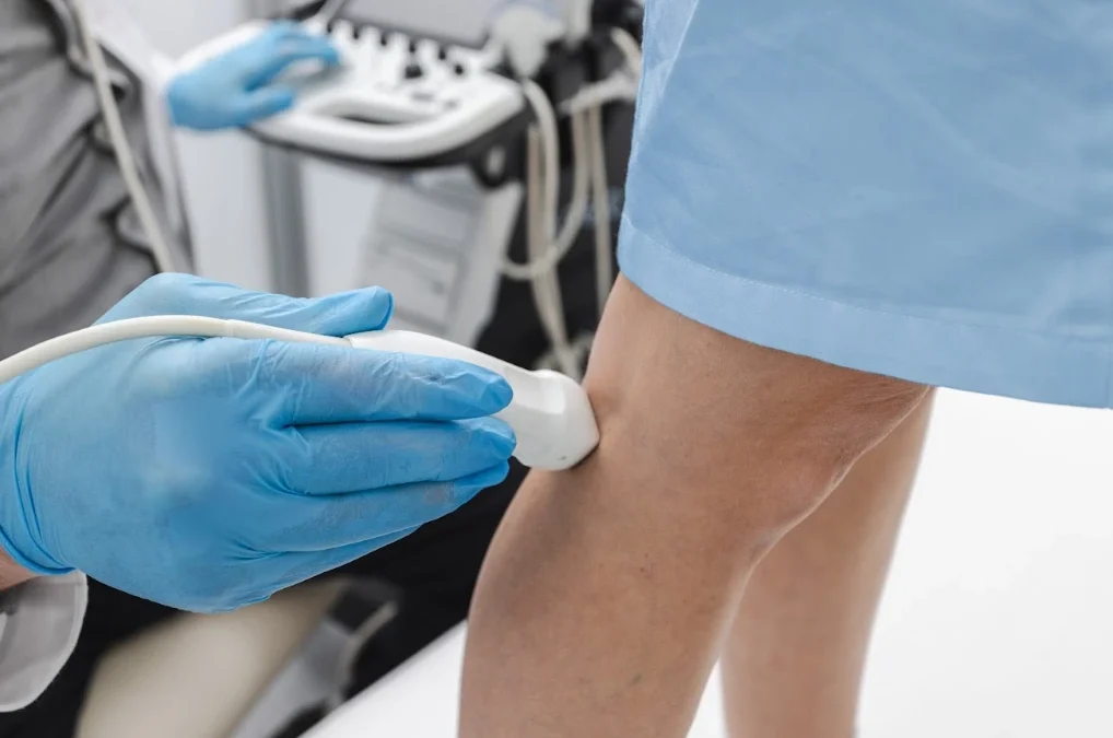 Find the Best Varicose Vein Treatment in Hamden, CT, With Dr. Martin Tyson