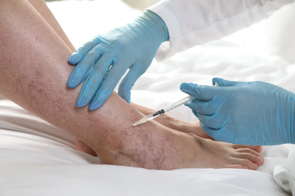 Find the best spider vein treatment in Cedar Park, TX