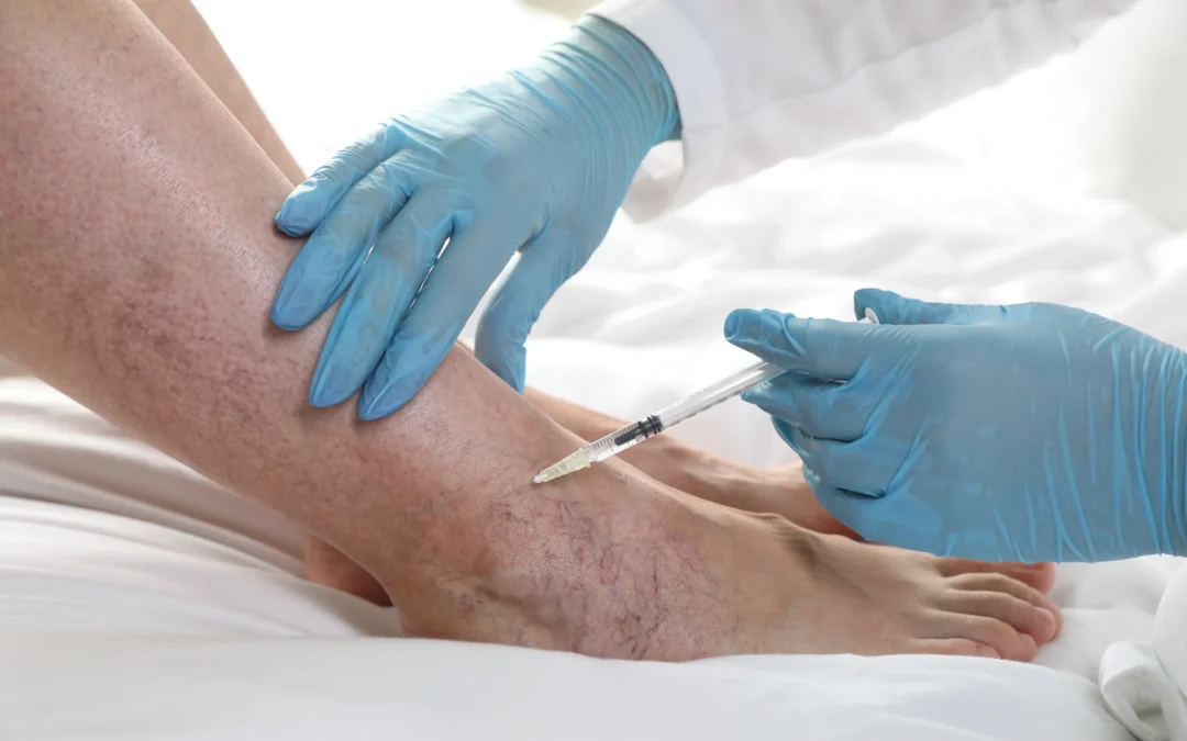 Find the best spider vein treatment in Cedar Park, TX