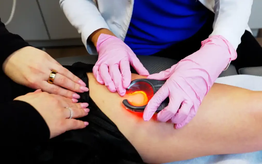 Find the Best Spider Vein Treatment in Farmington, CT