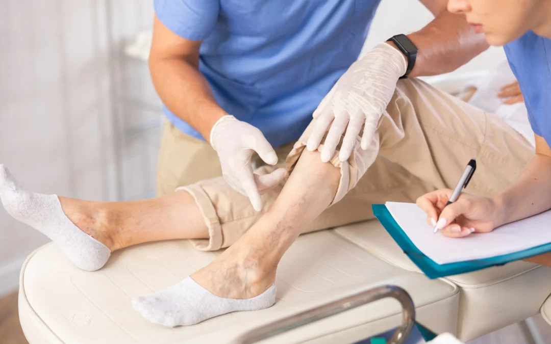 Vein treatment in Astoria. Get minimal invasive vein treatments