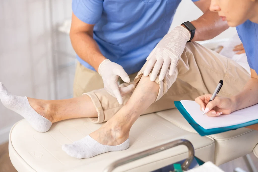 Vein treatment in Astoria. Get minimal invasive vein treatments