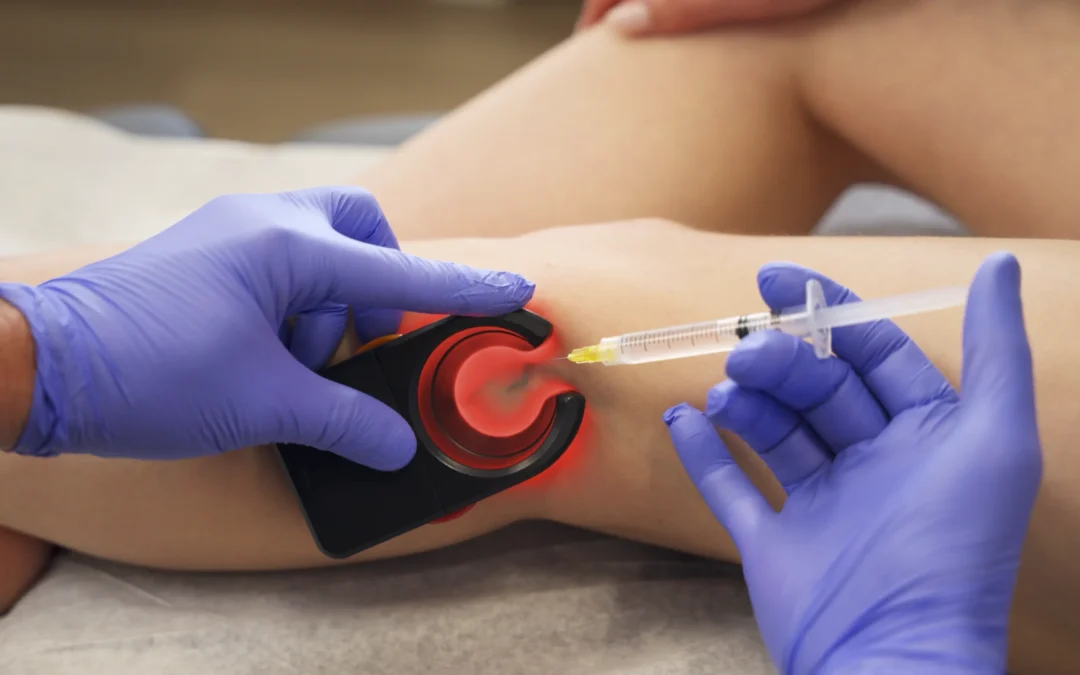 Where Can I Find Insurance-Covered Vein Treatments in Arlington, Texas?